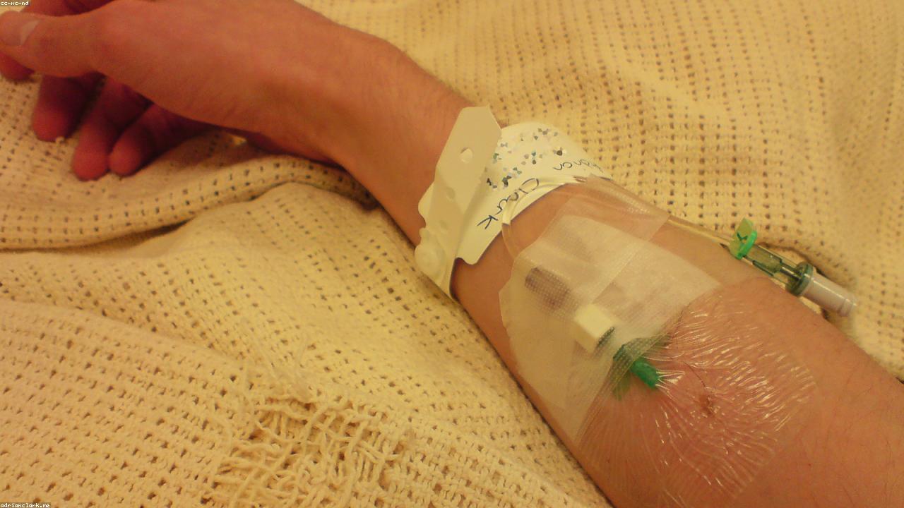 IV fluids and dehydration hydration therapy